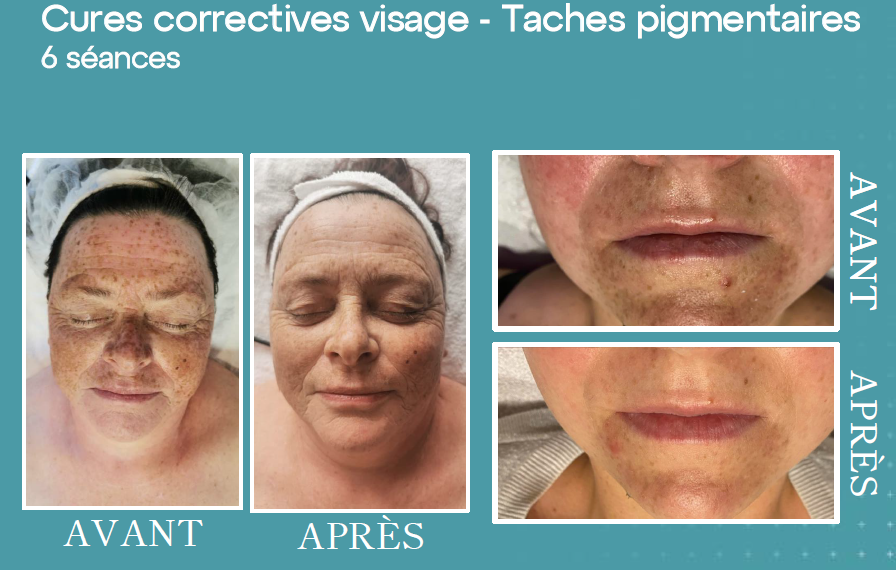 Capture d'écran 2025-09-27 112614 spray tan